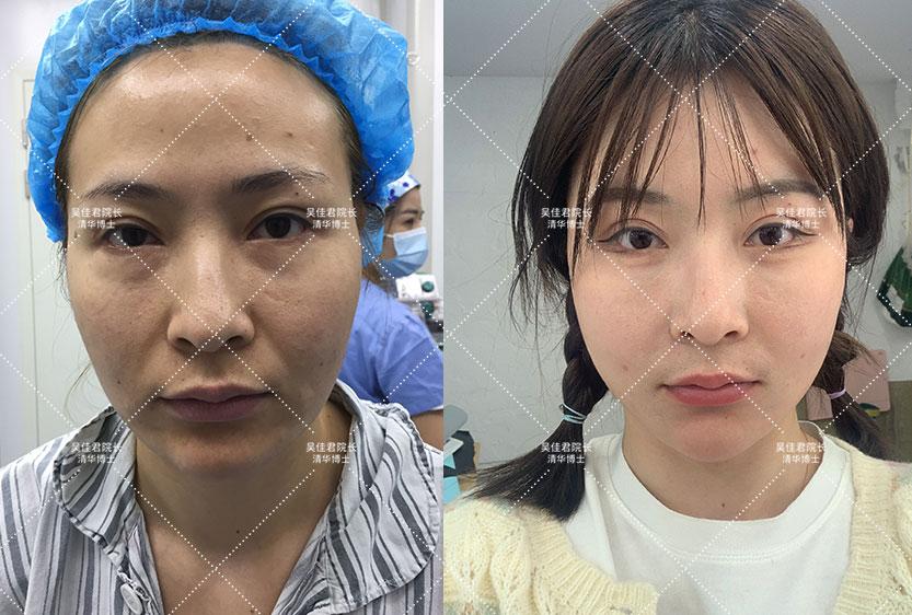 桂林_一肖一码一一肖一子善,戳穿行业洞察仔细释义、解释与落实